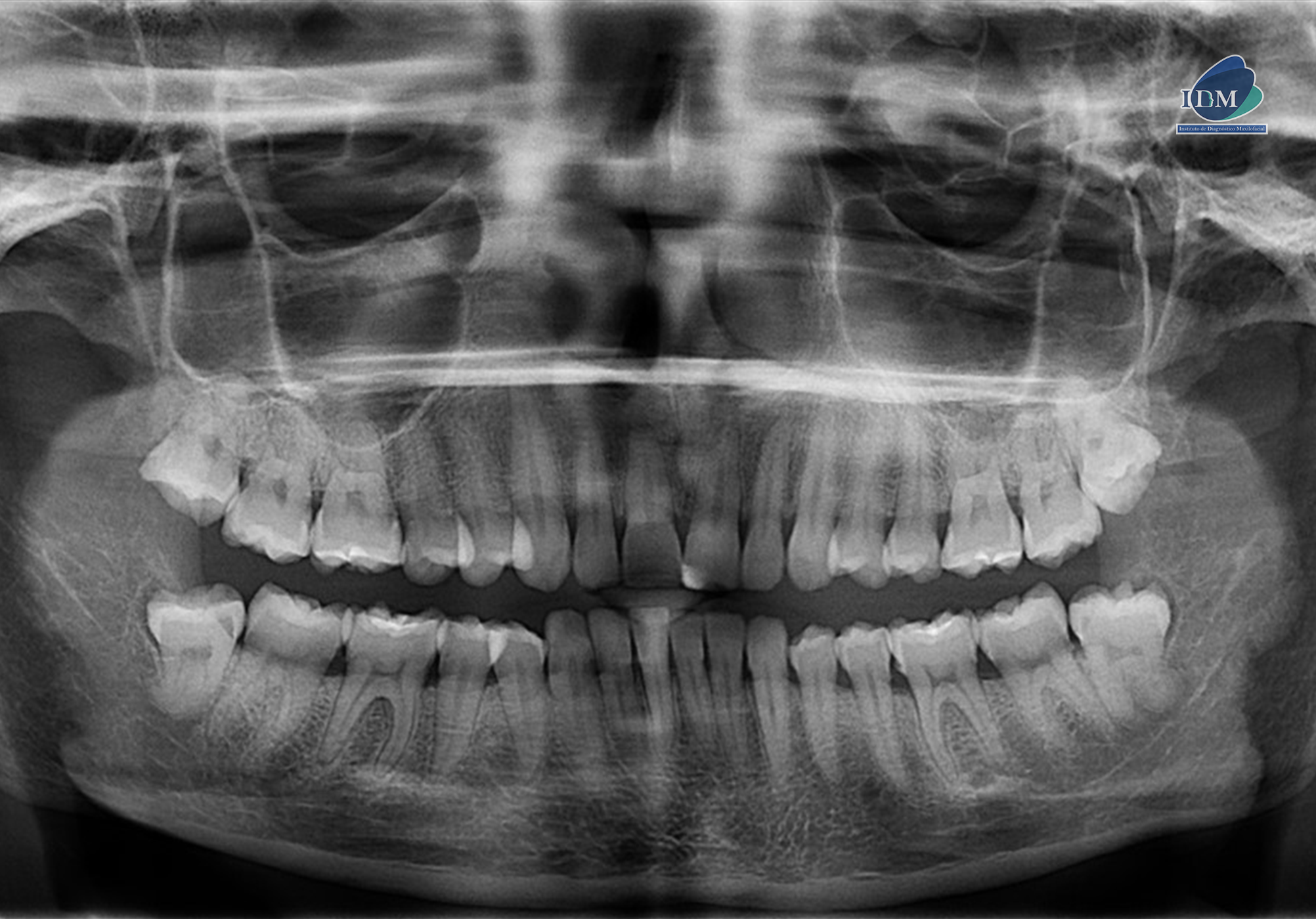 IDM CASO 284 PANORAMICA 2 IDM