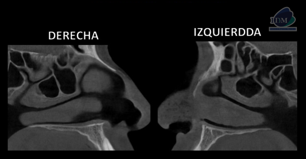 Caso 289 – IDM CORTES SAGITALES IDM