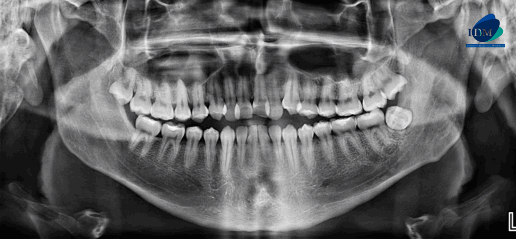 CASO 313 IDM radiografia panoramica 02