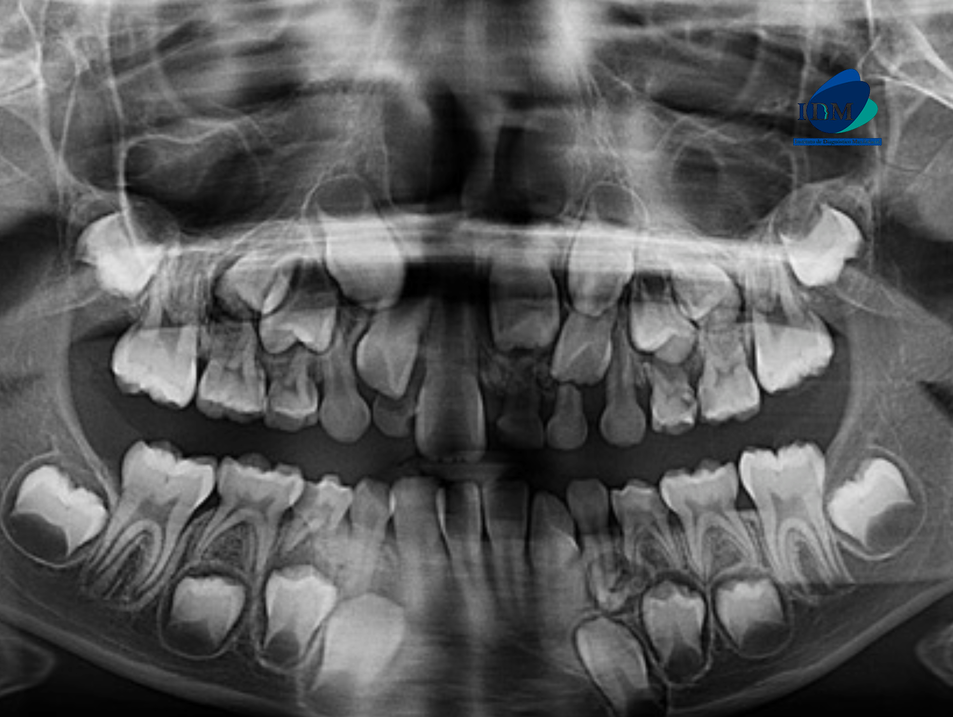 CASO 316 IDM radiografia panoramica 01