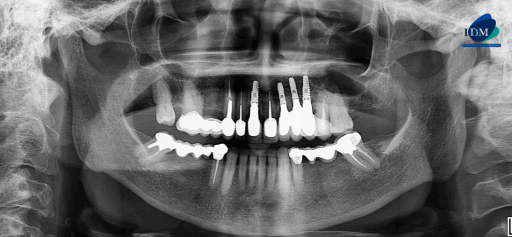 CASO 319 IDM - radiografia panoramica 02