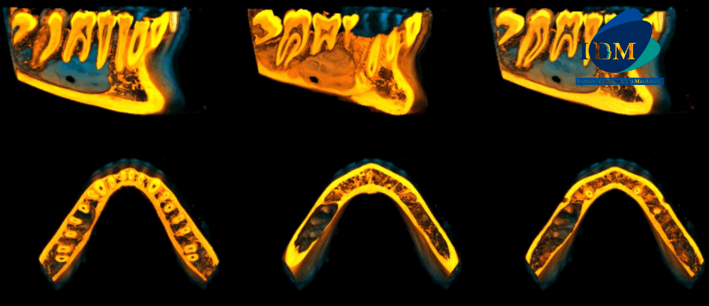 CASO 320 IDM - RECONSTRUCCION 3D