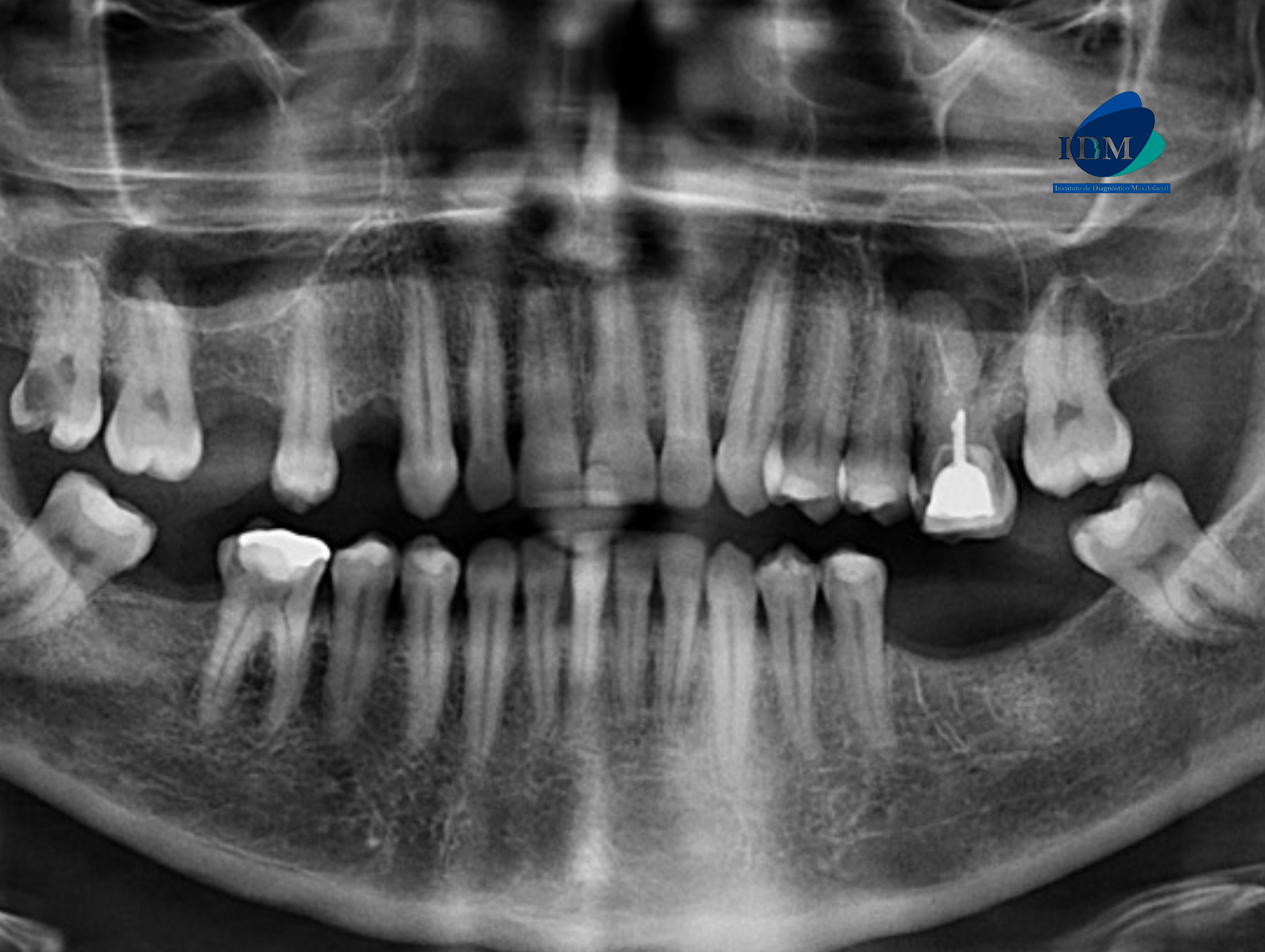 CASO 322 IDM - radiografia panoramica 01