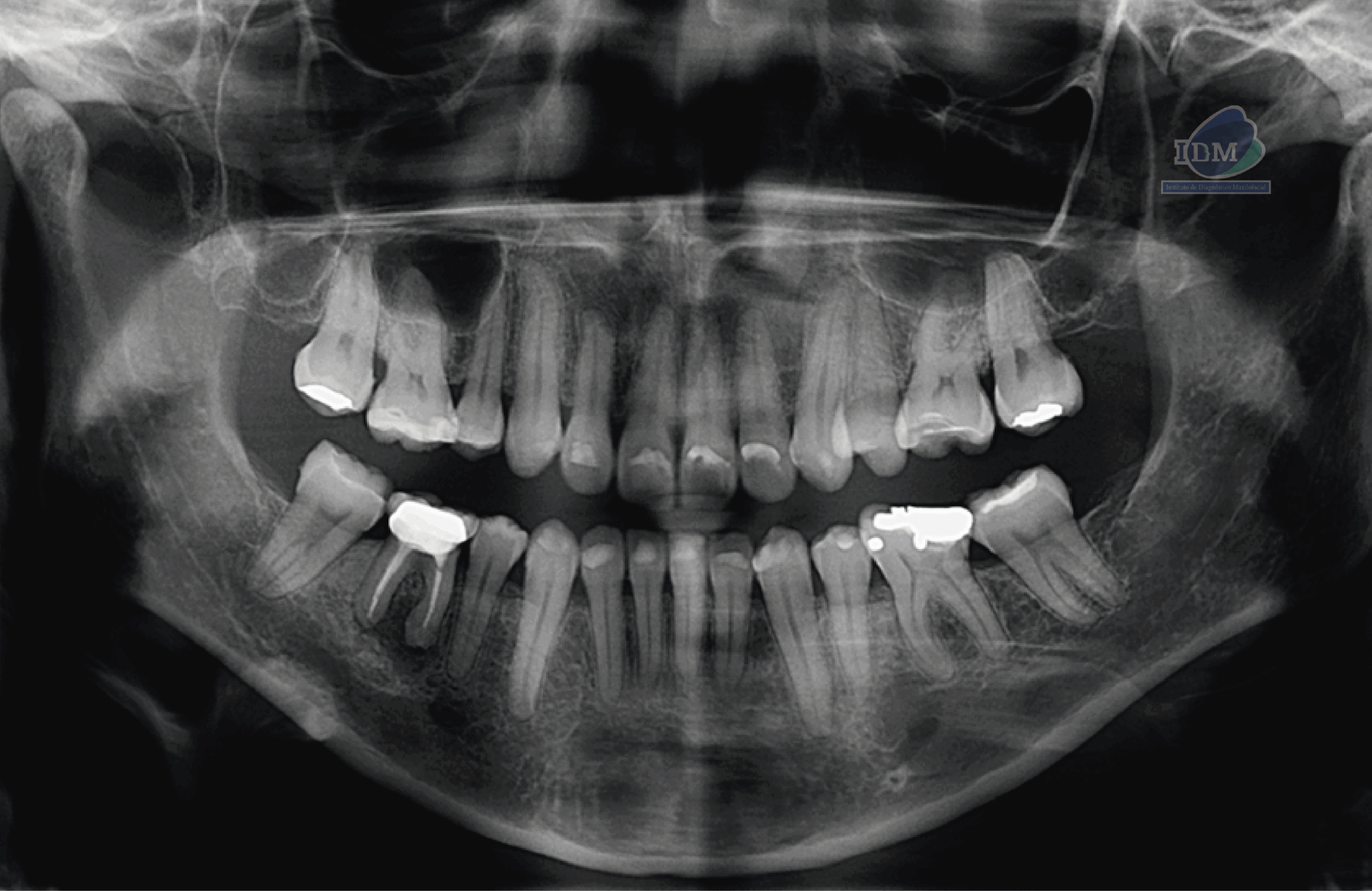 caso 326 radiografia panoramica 01