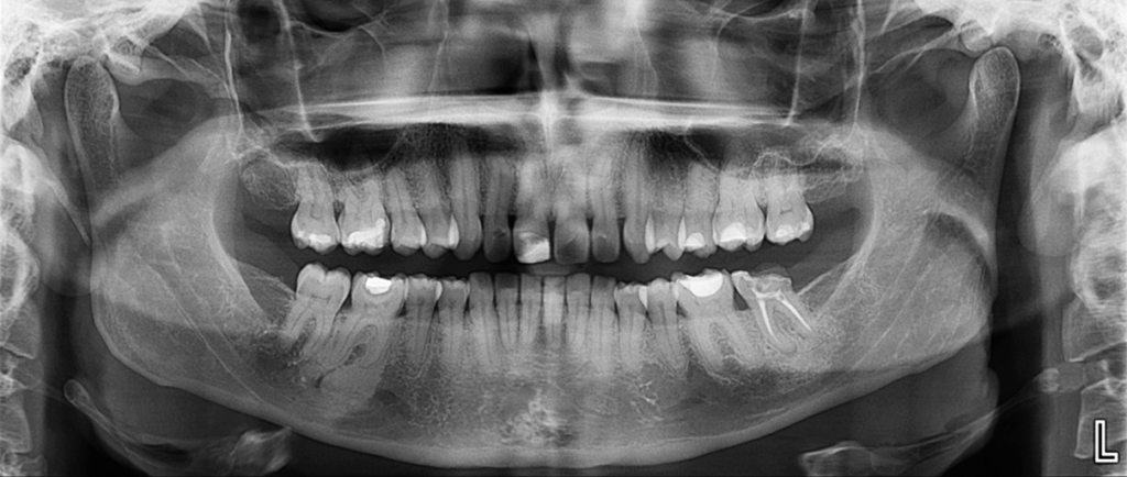 caso 327 radiografia panoramica