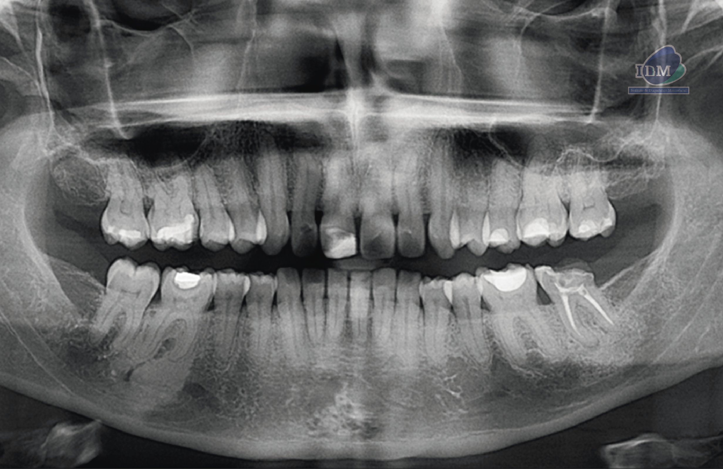 caso 327 - radiografia panoramica IDM 02