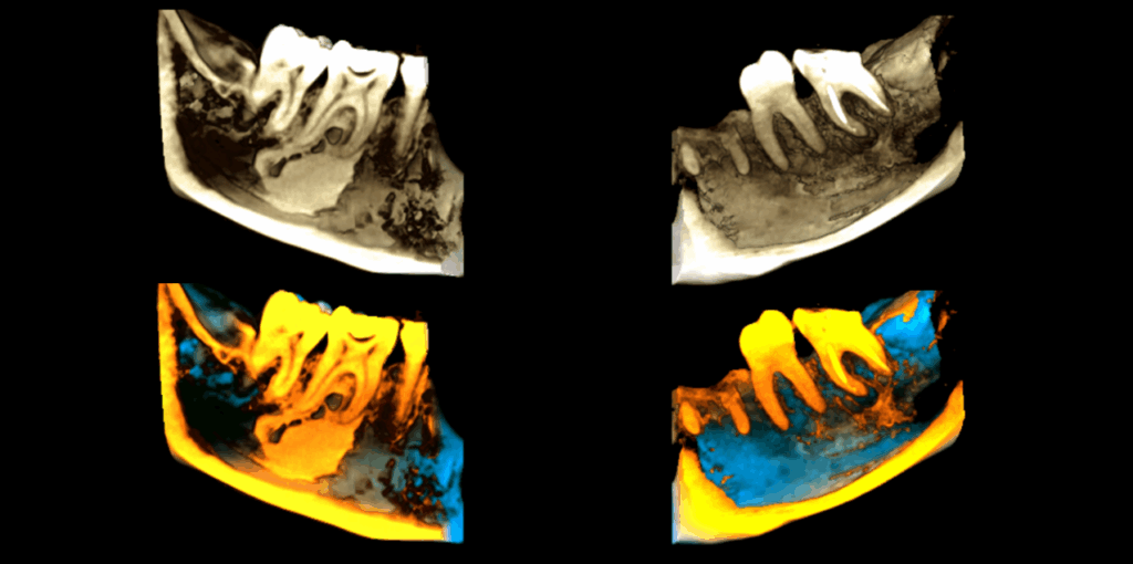 caso 327 reconstruccion 3d
