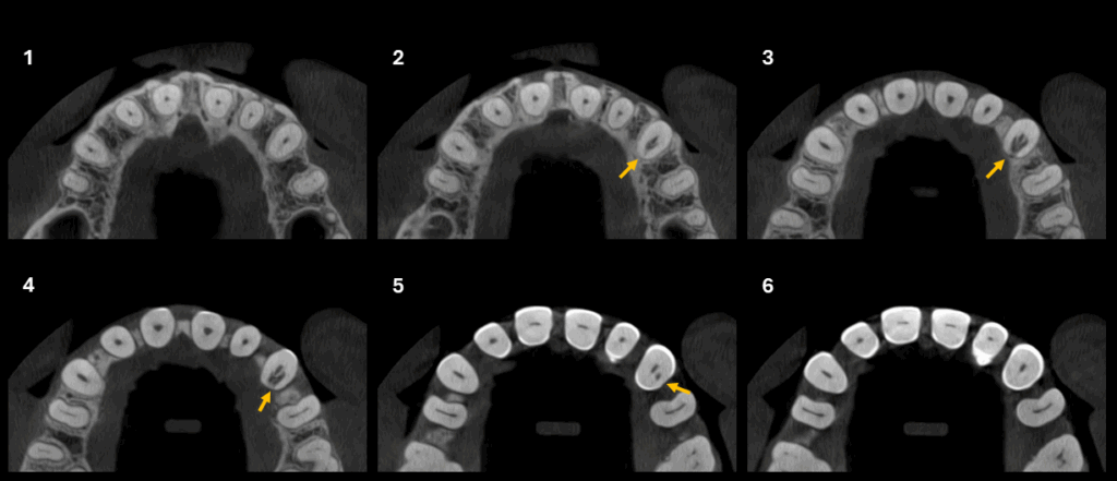 Caso 349 - Cortes Axiales