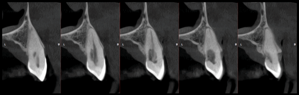 Caso 349 - Cortes Transaxiales