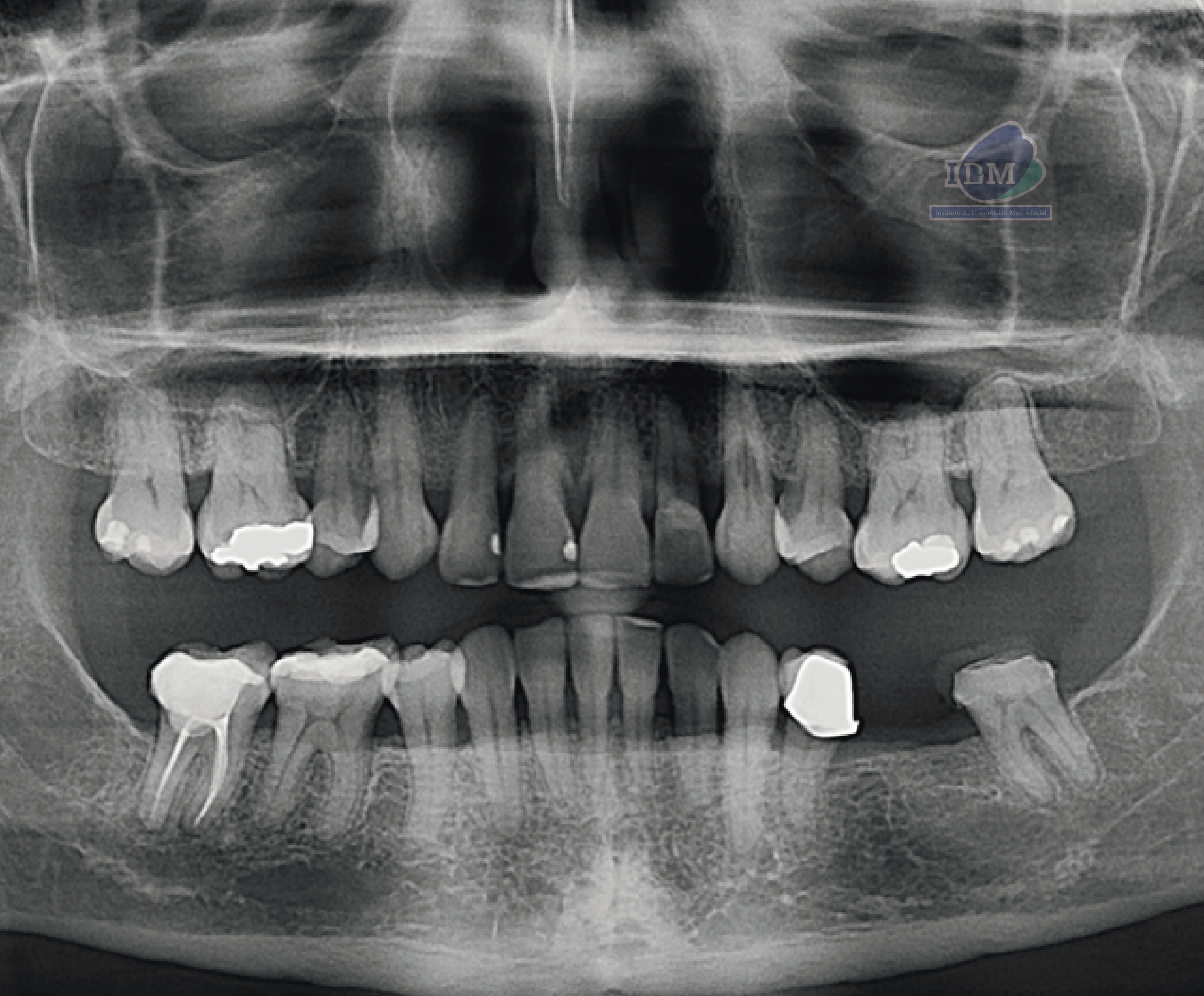 Caso 349 - Radiografía Panorámica 02_Rad Pan 01
