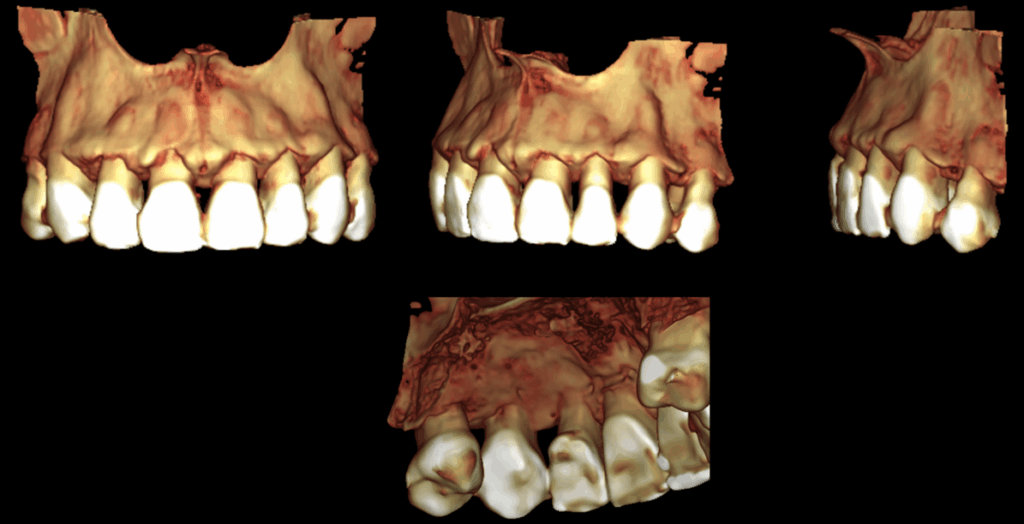 Caso 349 - Reconstriccion 3d - 1