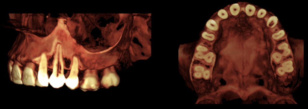 Caso 349 - Reconstriccion 3d - 2