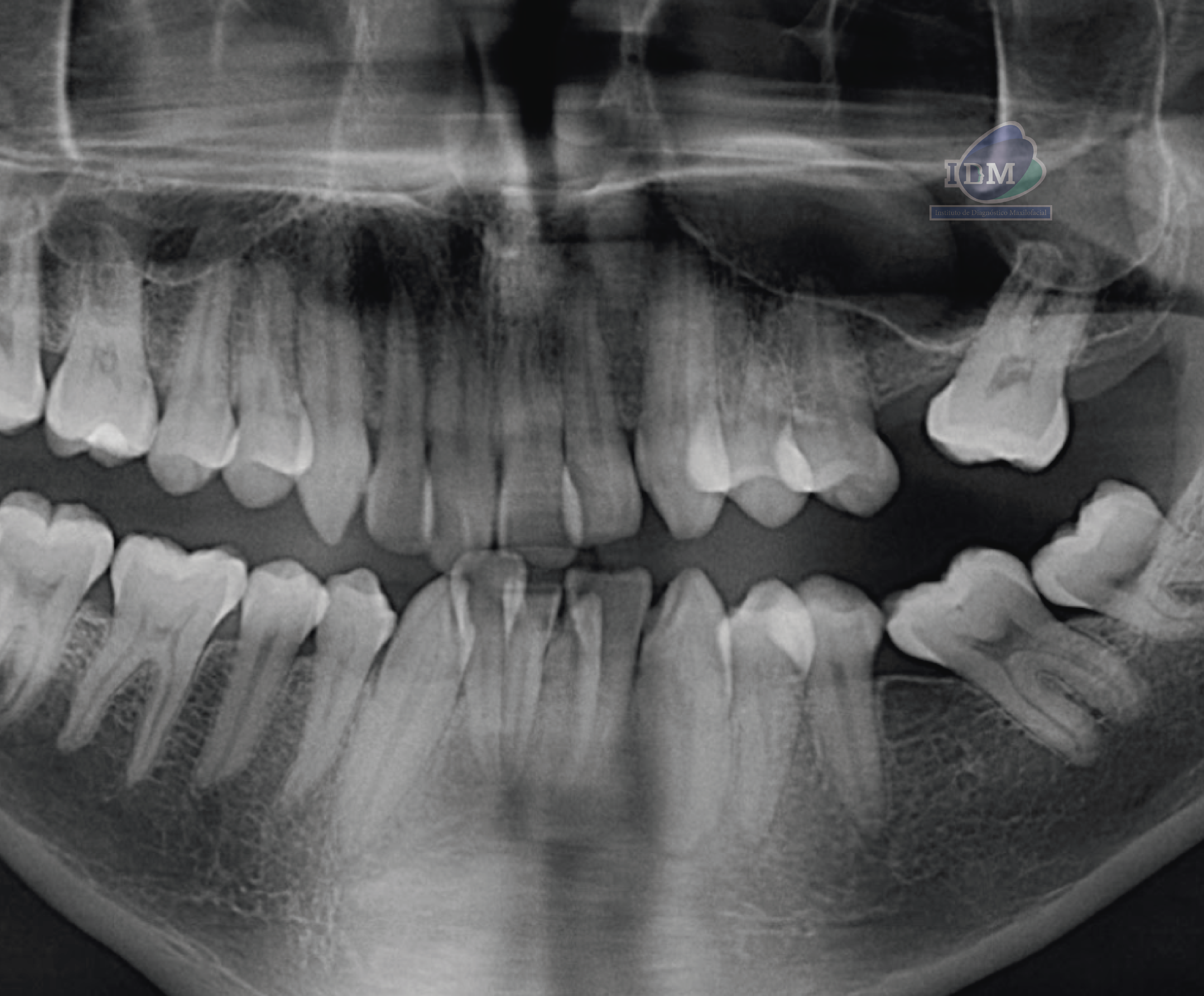 caso 344 - radiografia panoramica 02 IDM_Rad Pan 01