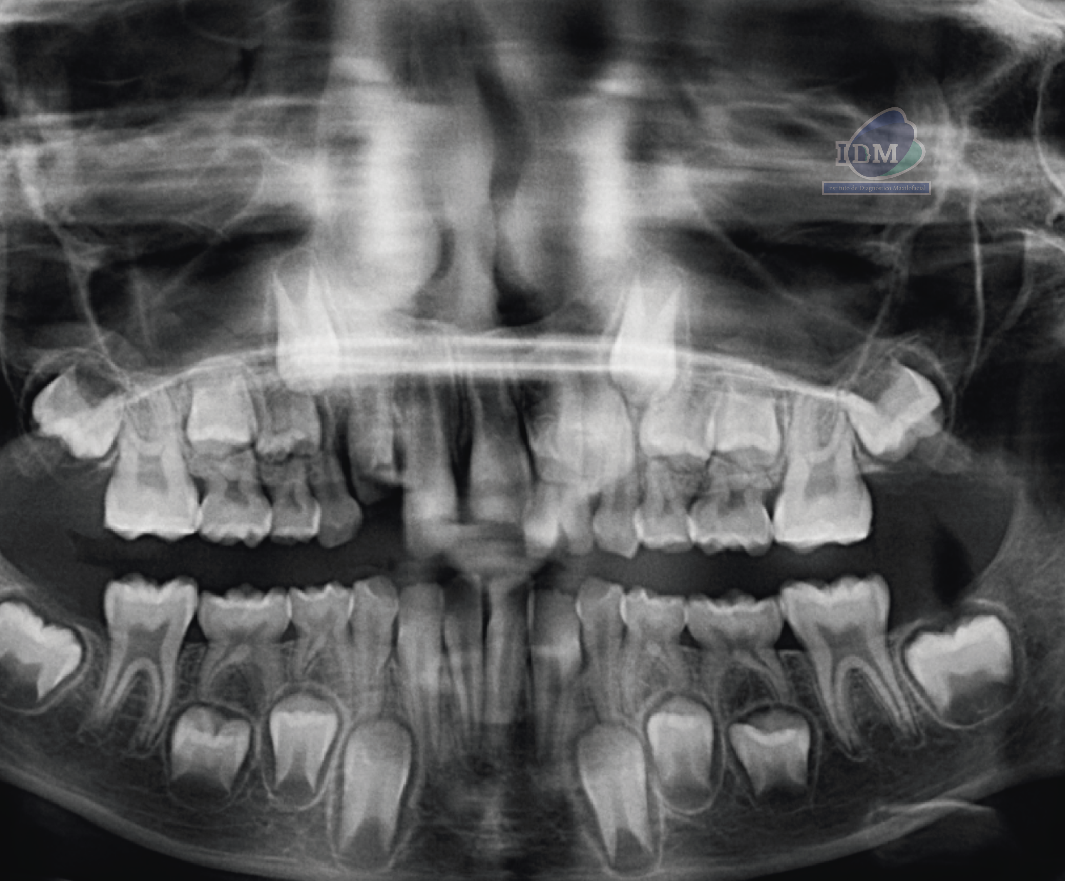 caso 343 - radiografia panoramica 02 IDM_Rad Pan 01