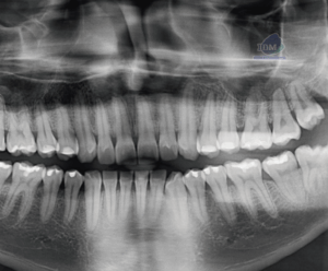 caso 345 - radiografia panoramica 02 IDM_Rad Pan 01