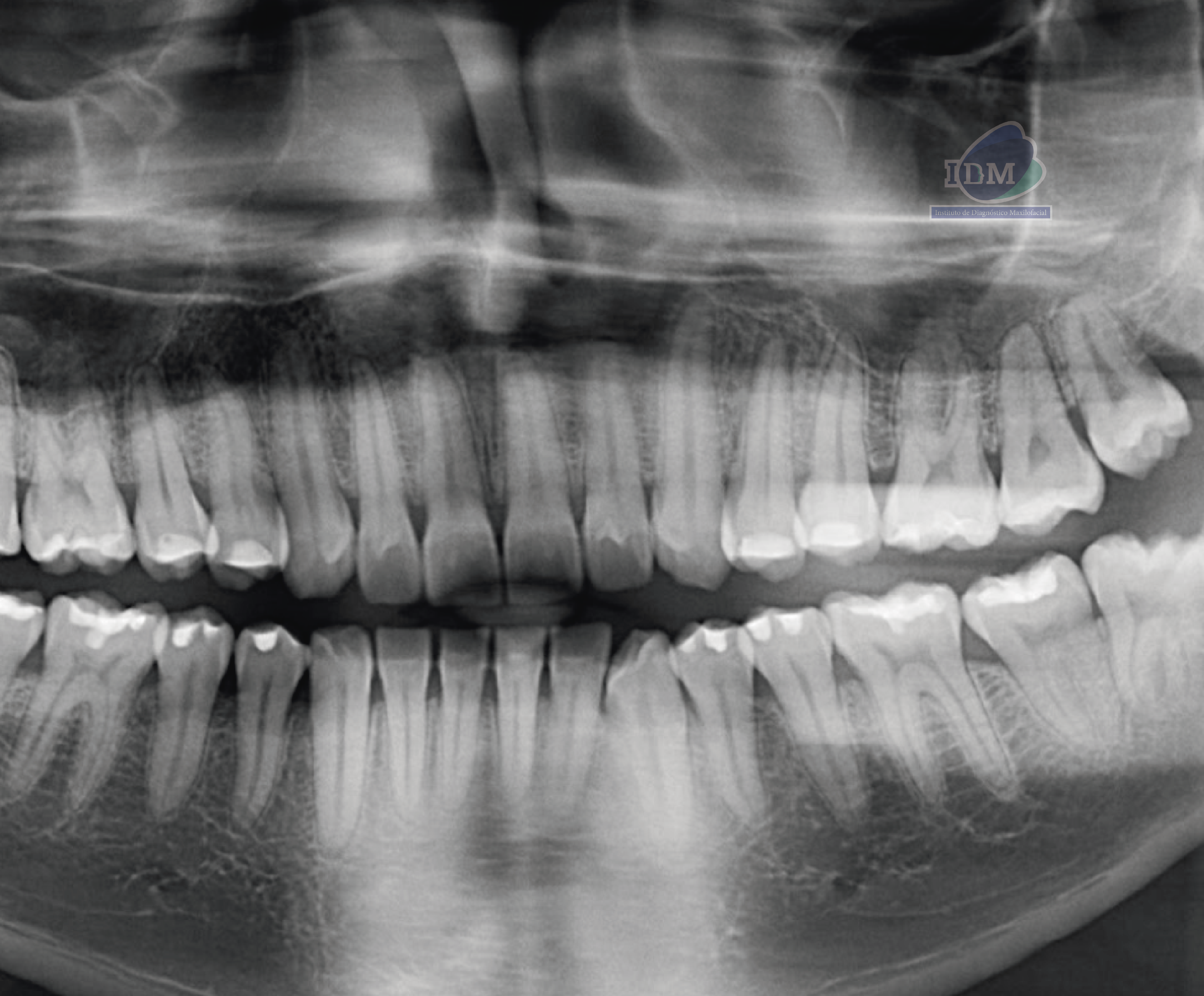 caso 345 - radiografia panoramica 02 IDM_Rad Pan 01