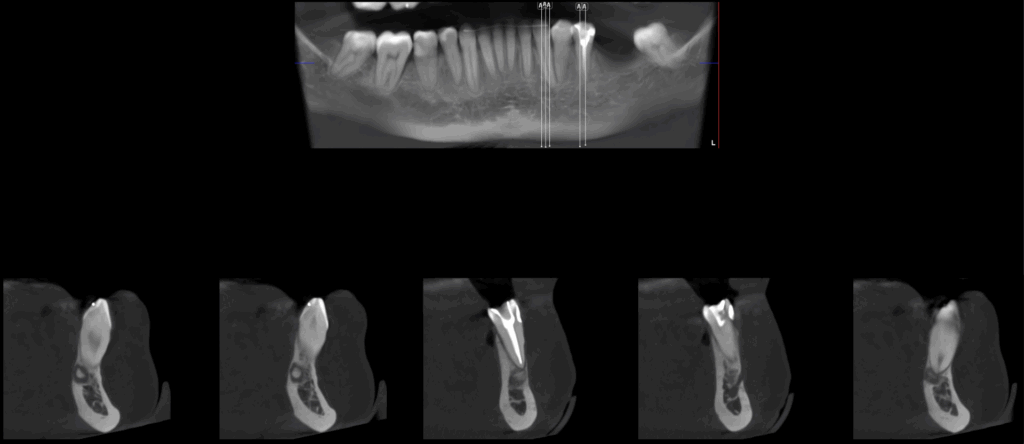 Caso 359 Cortes transaxiales - IDM