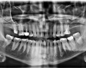 Caso 359 Radiografía panorámica v 2 - IDM