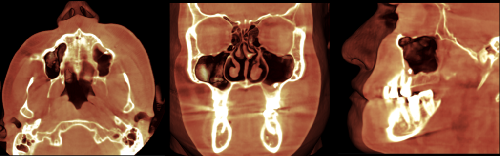 Caso 360 Reconstruccion 3D - IDM