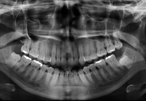 Caso 363 Radiografía panorámica - IDM V2